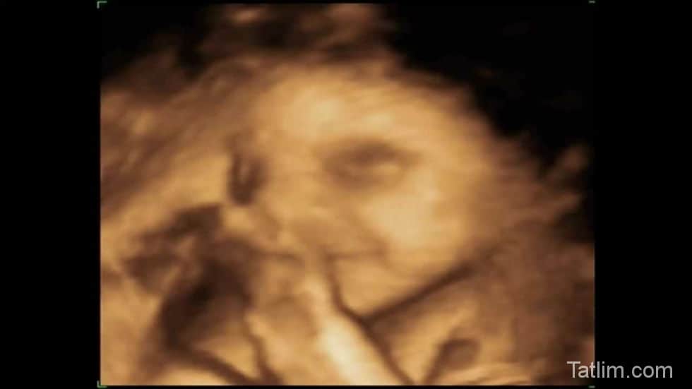 hamilelikte-29-hafta-ultrason-goruntusu